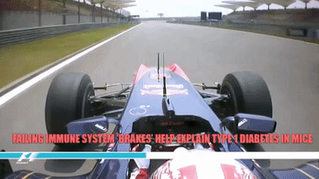 Brakes Tyres GIF