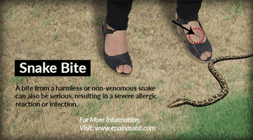 common symptoms of a snake bite GIF by ePainAssist