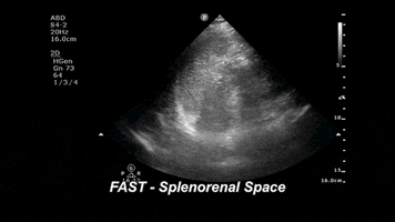drjeffy foamed foamus GIF