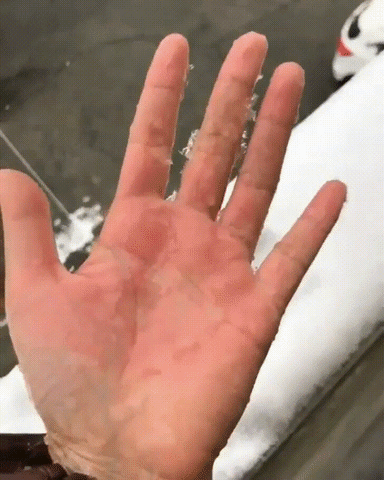 hand freezing GIF