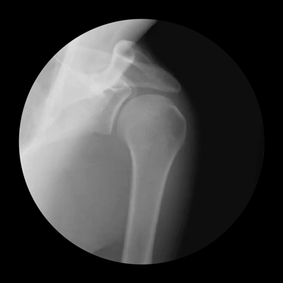 GifsdaFisio fisioterapia movimento anatomia ombro GIF