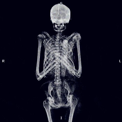 skeleton xray GIF