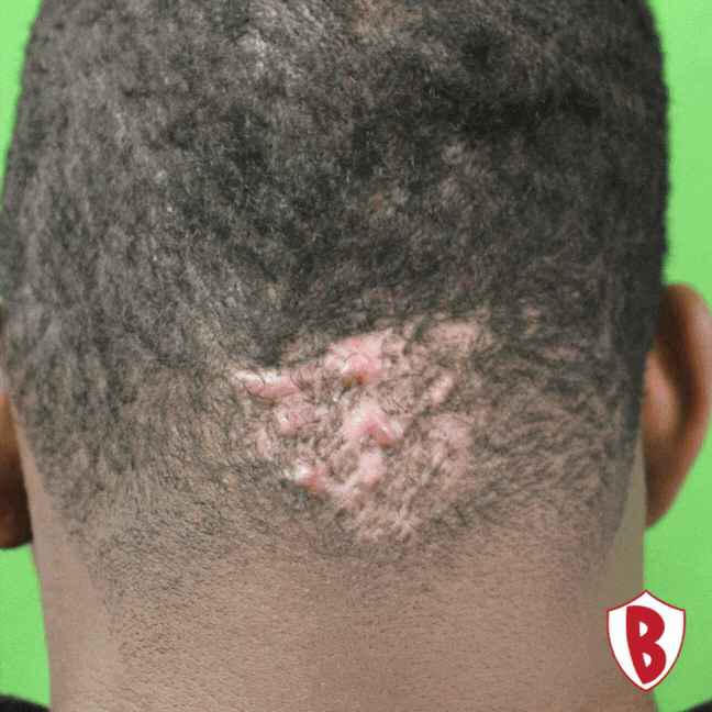 Dr. U Hair and Skin Clinic GIF