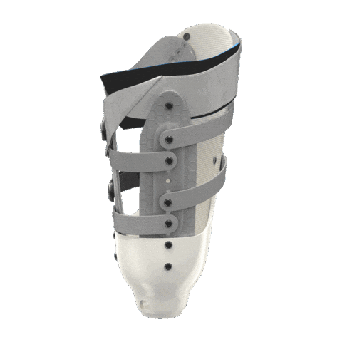 Above Knee Sticker by Martin Bionics