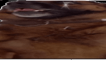 Dog GIF