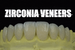 apostoldental teeth dentistry veneers zirconia GIF