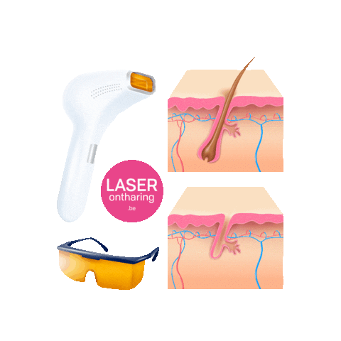 Laserontharing Sticker