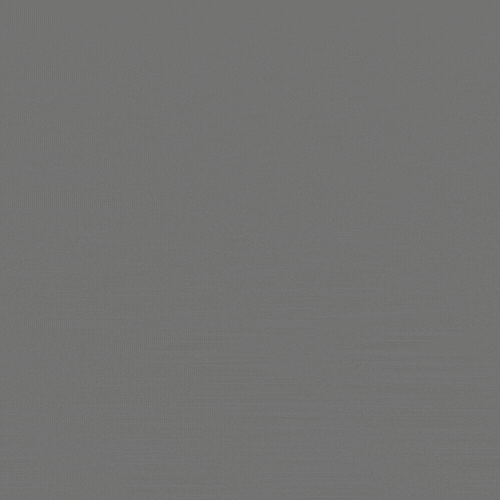 Buz Lazer  - Epilasyonda Başka Boyut GIF