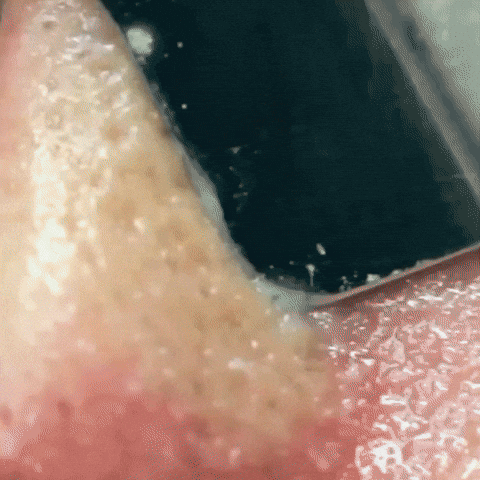 Nettoyeur De Peau Ultrasonique Theblisstech GIF