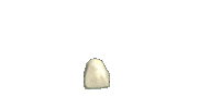 Crown Tooth Sticker by Oral Arts Dental Laboratory