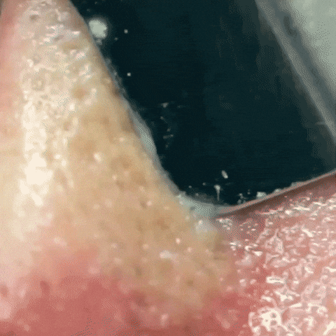 Nettoyeur De Peau Ultrasonique Theblisstech GIF