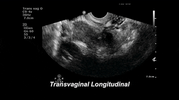 drjeffy foamed foamus GIF