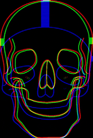 skull skeleton GIF by proj.implanto.ufpel