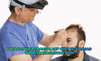 Hair Transplant GIF