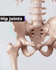 Joint Impingement, A Common Structural Issue