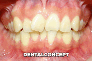 davidantoniovilcaobregon dentalconcept GIF