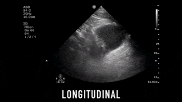 drjeffy foamed foamus GIF
