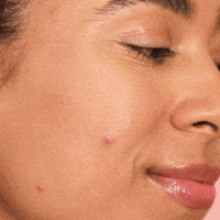 Pimple Patch GIFs - Find & Share on GIPHY