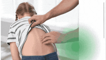 مركز علاج الجنف GIF