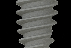 singularimplants GIF