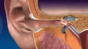 Ear GIFs - Find & Share on GIPHY