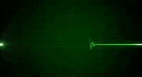 heart rate monitor flatline gif