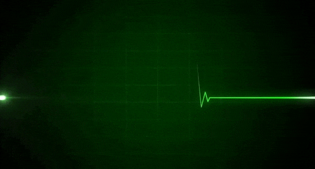Heartbeat Monitor Flatline Gif