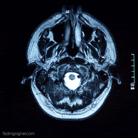 medical school brain GIF
