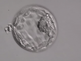 Blastocyst GIF