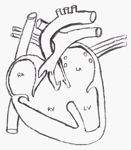 Congenital Heart Defects GIF