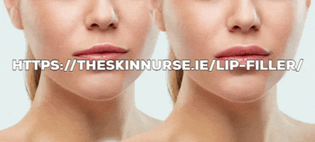 Lip Fillers GIF