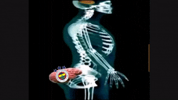 No Brain Galatasaray GIF
