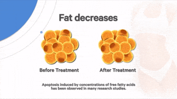 Cmslim GIF