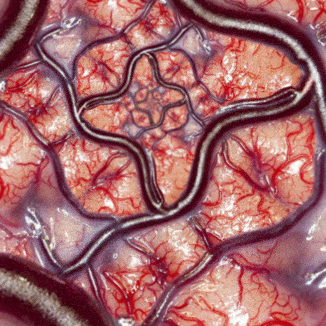 brain