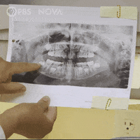 Teething Mental Health GIF by PBS Digital Studios