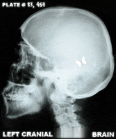 hentai xray vision hentai xray vision