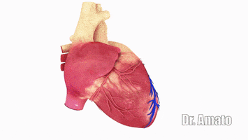 Arterial GIF