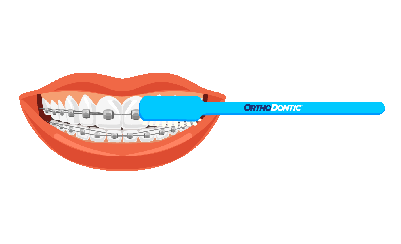 Sticker by OrthoDontic for iOS & Android GIPHY