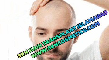 Hair Transplant GIF
