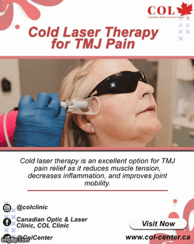 Rosacea Vascular Treatment Victoria Bc GIF