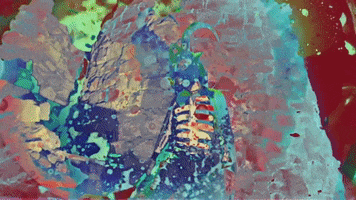 200.gif?cid=fc005b08bb3dd40d6c0e6ca1bae2f5f707e7ee5160ef298c&rid=200.gif&ct=g
