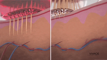 Vivace GIF