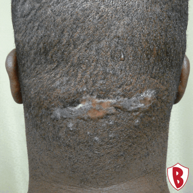 Dr. U Hair and Skin Clinic GIF