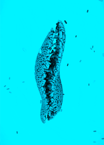 bacteria GIF by Alastair Gray