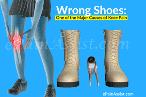 wrong shoes one of the major causes of knee pain GIF by ePainAssist