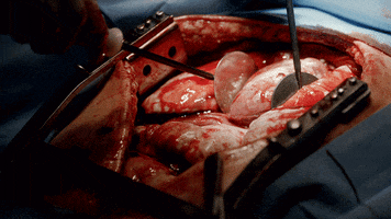 Heart Transplant Fox GIF by Wayward Pines