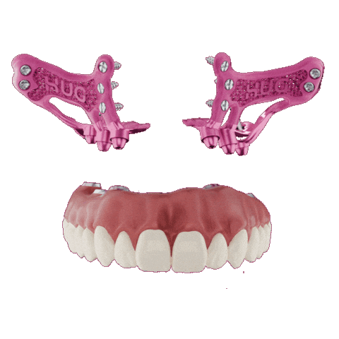 Implant Hug Sticker by Biotech Dental