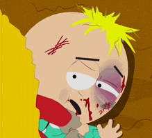 Beat Up Black Eye GIF by South Park