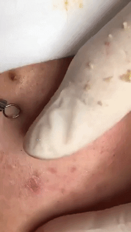 Ring Spa GIF