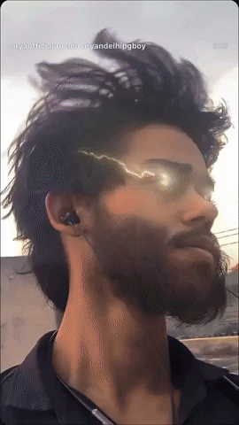 Aryan Beard Transplant GIF